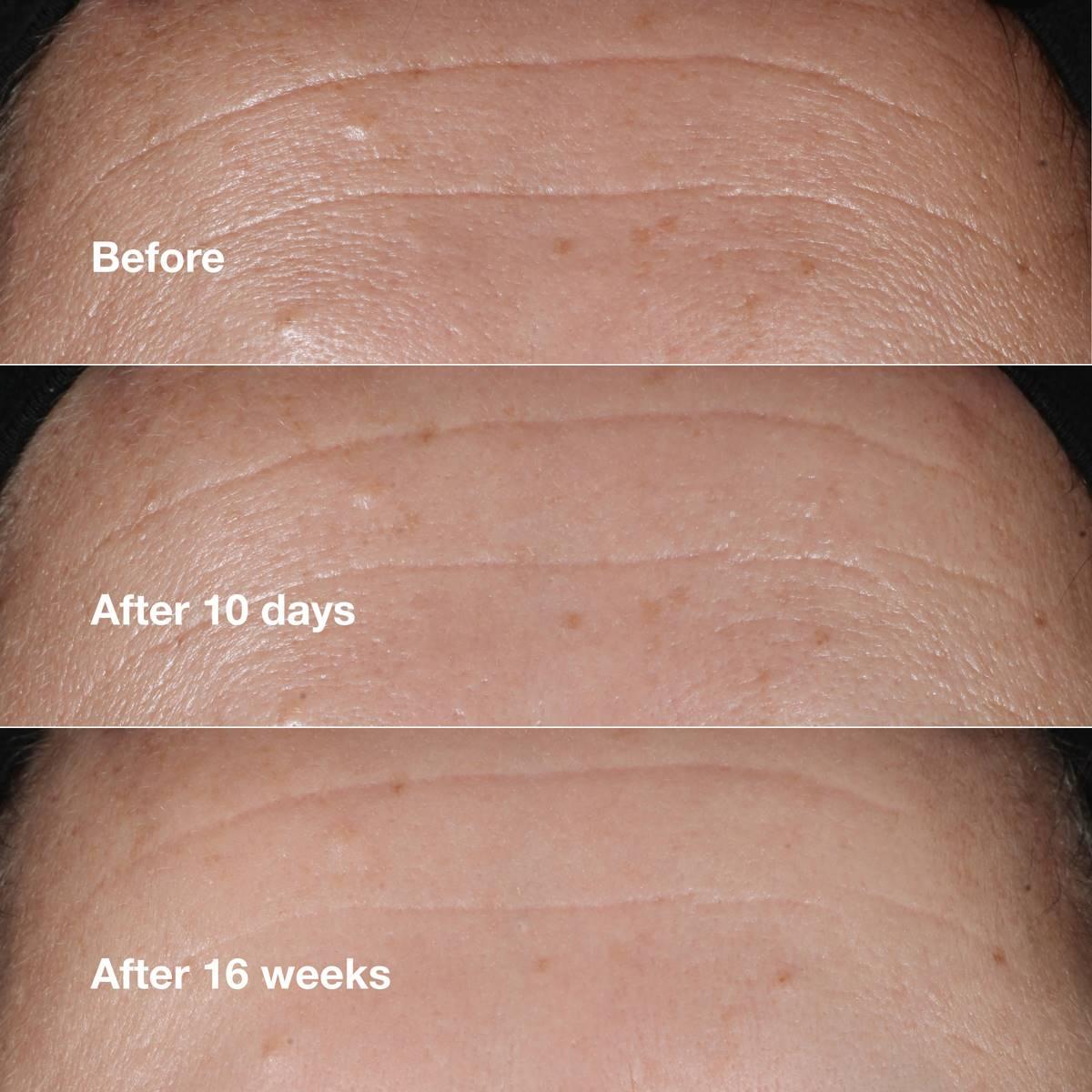 Clinique Smart Clinical Repair™ Wrinkle Correcting Serum