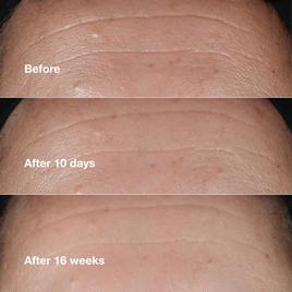 Clinique Smart Clinical Repair™ Wrinkle Correcting Serum