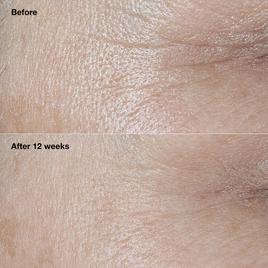 Clinique Smart Clinical Repair™ Broad Spectrum Wrinkle Cream