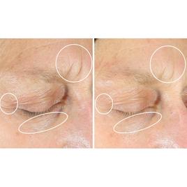 StriVectin Intensive Eye Concentrate for Wrinkles Plus 1 oz.