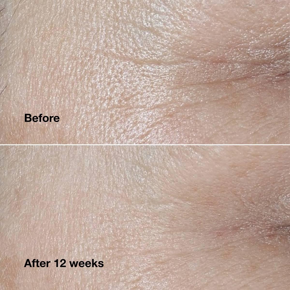 Clinique Smart Clinical Repair™ Wrinkle Correcting Face Cream