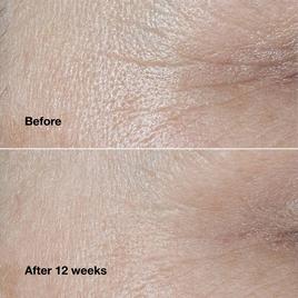 Clinique Smart Clinical Repair™ Wrinkle Correcting Face Cream