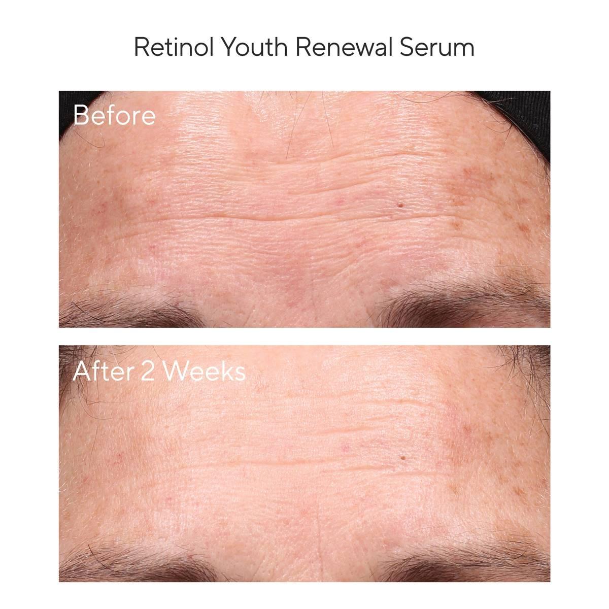 Murad Retinol Youth Renewal Serum