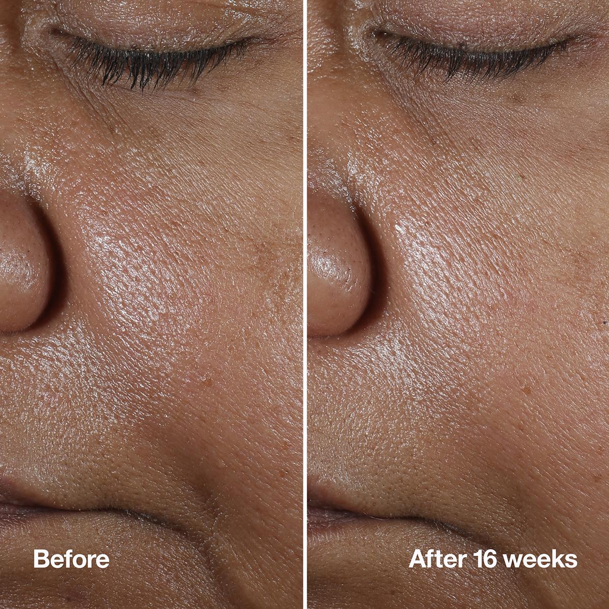 Clinique Smart Clinical Repair™ Wrinkle Correcting Serum